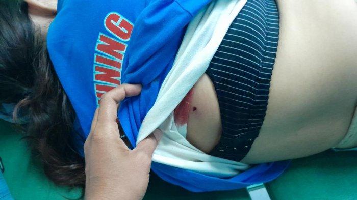 Korban Peluru Ngaco di Buleleng Bali Kini Pulang Setelah Operasi Selesai