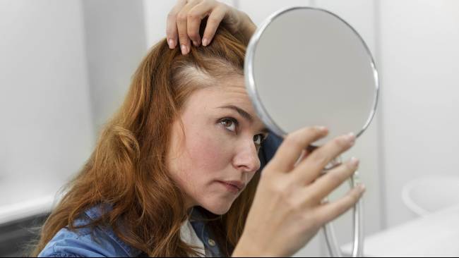 5 Alasan Rambut Menipis yang Perlu Anda Waspadai